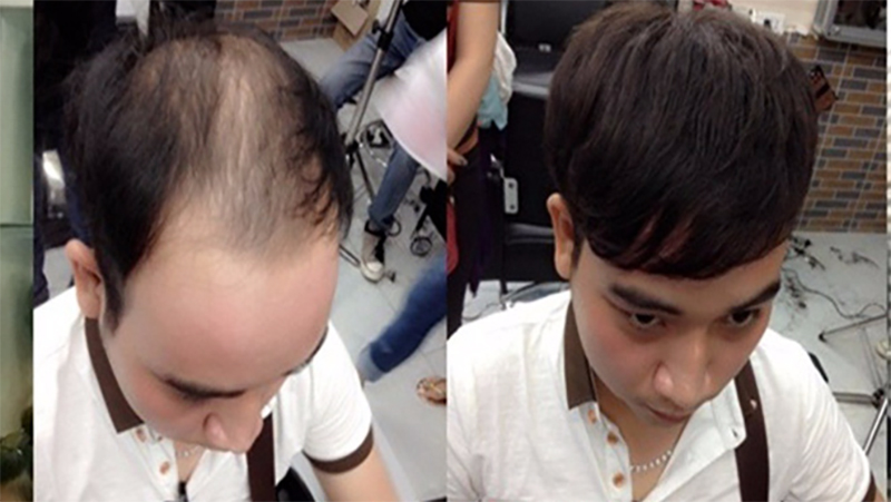 Loạt hình ảnh chứng minh: Với một số phụ nữ, quan trọng không phải là thần thái mà là tóc mái